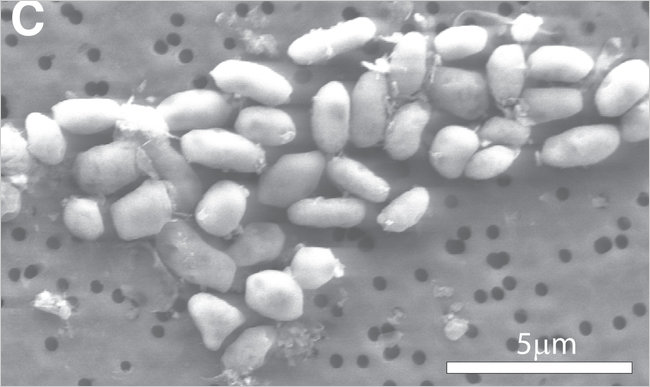 What kills you, makes them stronger – Bacteria lives on Arsenic