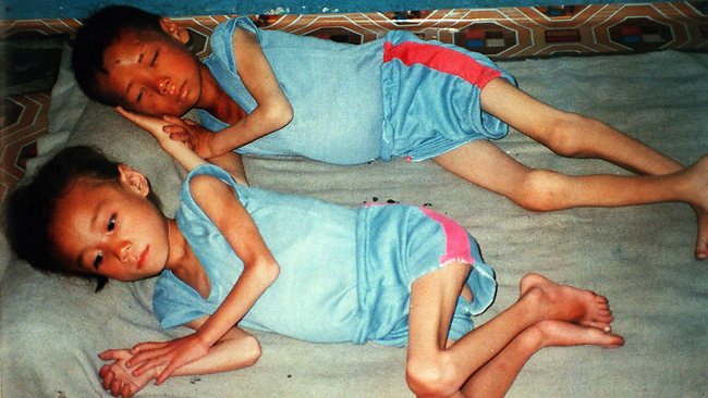 Starving North Koreans ‘are forced to eat their children
